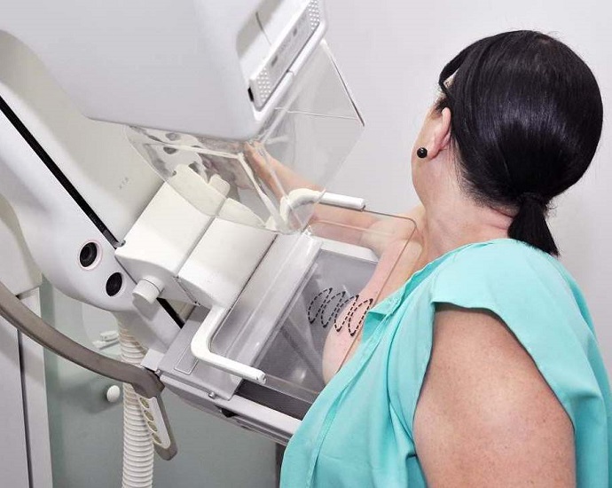 PREVENÇÃO: Carreta da Mamografia estará em Jales para realizar exames em mulheres com idades entre 50 e 69 anos